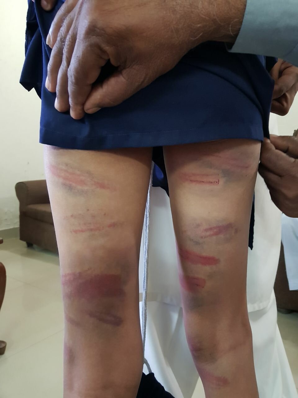 Police arrest teacher for torturing student in Abbottabad