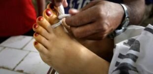 Girl injured over matrimonial dispute dies at hospital Girl injured over matrimonial dispute dies at hospital